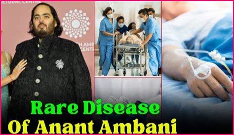 Unraveling The Mystery: What Disease Anant Ambani Is Having?
